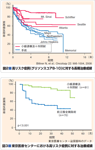 図2 高リスク症例(グリソンスコア8-10)に対する長期治療成績
図3 東京医療センターにおける高リスク症例に対する治療成績