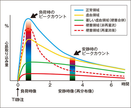 Tl 動態の経時的変化　図