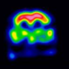 CAPPAH sign(Convexity APPArent. Hyperperfusion)-2