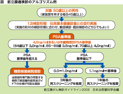 前立腺 癌 検査