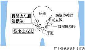 図1　骨盤底筋膜温存法