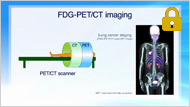 FDGスキャン注のご紹介