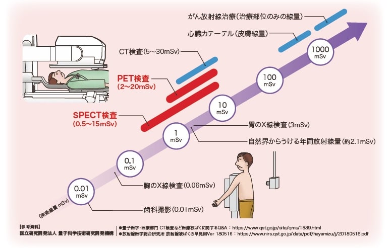 PET検査の放射線