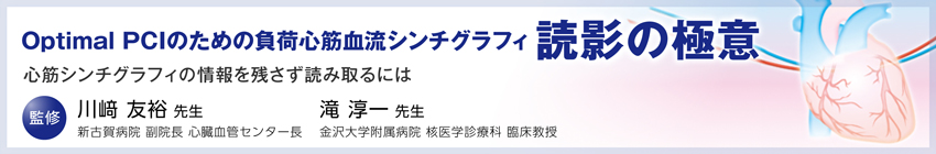 Optimal PCIのための負荷心筋血流シンチグラフィ 読影の極意