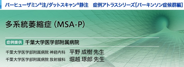 パーヒューザミン注／ダットスキャン静注 パーキンソン症候群　症例アトラスシリーズ 多系統萎縮症(MSA-P) 症例提供 千葉大学医学部附属病院 千葉大学医学部附属病院 神経内科　平野 成樹 千葉大学医学部附属病院 放射線科　堀越 琢郎