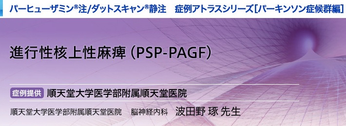 パーヒューザミン注／ダットスキャン静注 パーキンソン症候群　症例アトラスシリーズ 進行性核上性麻痺(PSP-PAGF) 症例提供 順天堂大学医学部附属順天堂医院 順天堂大学医学部附属順天堂医院 脳神経内科　波田野 琢