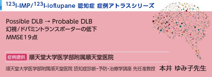 123I-IMP/123I-ioflupane認知症 症例アトラスシリーズ レビー小体型認知症  Possible DLB → Probable DLB幻視/ドパミントランスポーターの低下MMSE19点 順天堂大学医学部附属順天堂医院 順天堂大学医学部附属順天堂医院 認知症診断・予防・治療学講座 先任准教授　本井 ゆみ子先生 紹介した症例は臨床症例の一部を紹介したもので、全ての症例が同様な結果を示すわけではありません。 3D-SSP/DaTViewによる画像解析は核医学画像解析ソフトウェアmedi+FALCONを使用することで実施可能です。