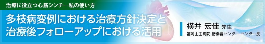 治療に役立つ心筋シンチ-私の使い方5