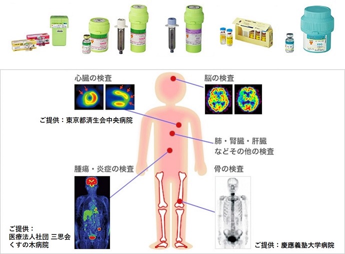 放射性医薬品とSPECT検査