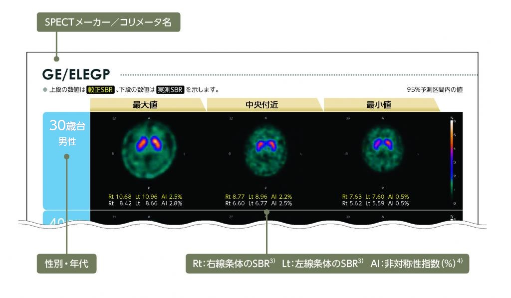 健常成人の123IイオフルパンSPECT画像掲載方法