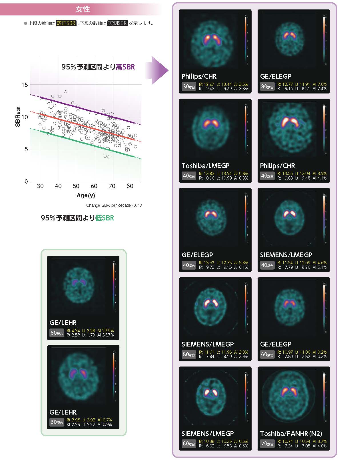 各社SPCT画像女性.jpg