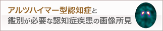 アルツハイマー型認知症と鑑別が必要な認知症疾患の画像所見