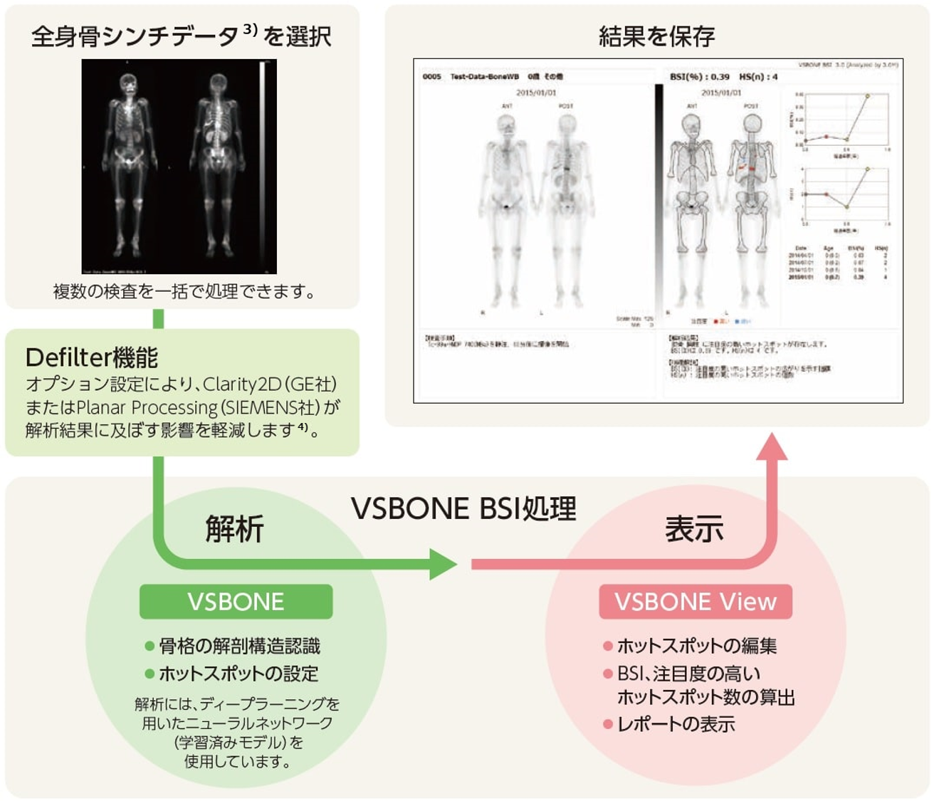 VSBONE BSIの処理フロー