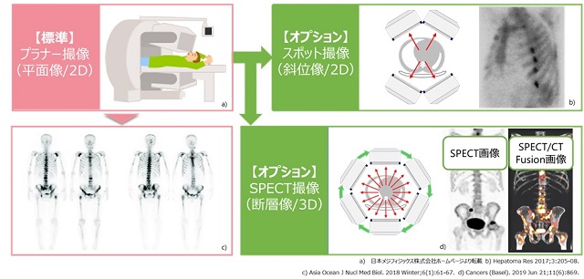 骨シンチグラフィの撮像法