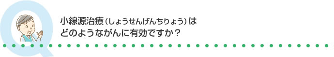 小線源治療(しょうせんげんちりょう)はどのようながんに有効ですか？