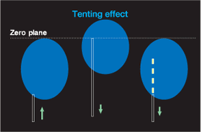 Tenting effect　技術的な注意点