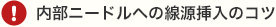 内部ニードルへの線源挿入のコツ