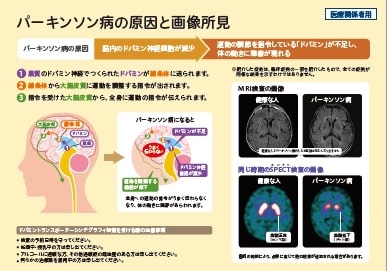 パーキンソン病の原因と似た病気での画像所見