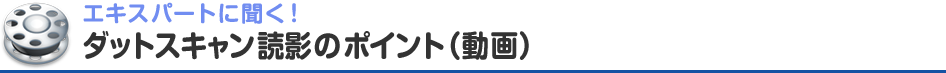 エキスパートに聞く！ ダットスキャン読影のポイント（動画）