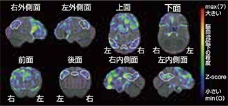 T1WI画像