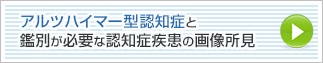 アルツハイマー型認知症と鑑別が必要な認知症疾患の画像所見