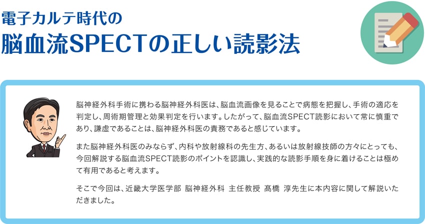 電子カルテ時代の脳血流SPECTの正しい読影法