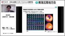 3断面、ポーラーマップの読み方