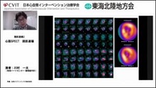 症例1　70代男性 労作時胸痛(非典型的)