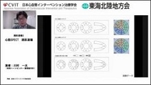 症例2　薬物負荷シンチ画像から考察する