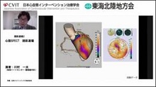 症例3　60代男性 無症状(糖尿病、高血圧、脂質異常症あり)