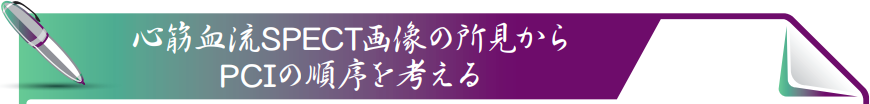 心筋血流SPECT画像の所見からPCIの順序を考える