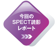 今回のSPECT読影レポート