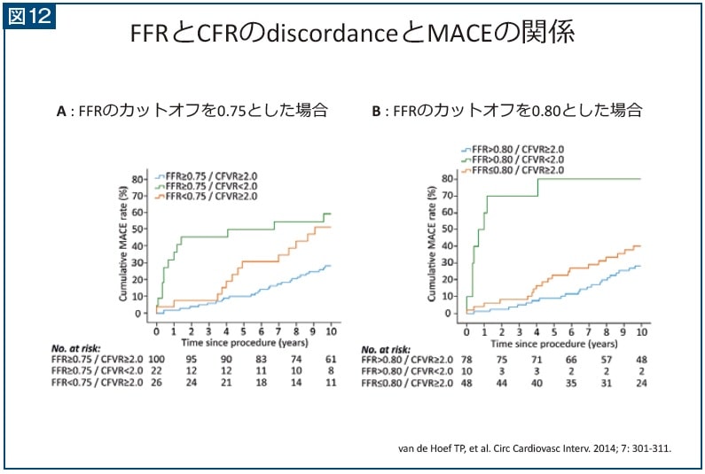 図12 FFRとCFRのdiscordanceとMACEの関係