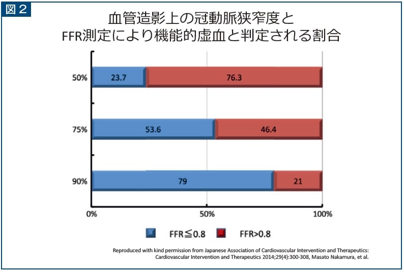 図2 血管造影上の冠動脈狭窄度とFFR測定により機能的虚血と判定される割合