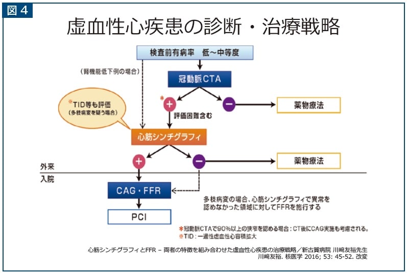 図4 虚血性心疾患の診断・治療戦略