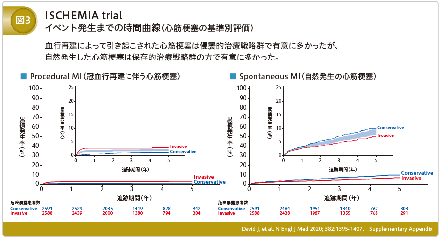 ISCHEMIA trial イベント発生までの時間曲線(心筋梗塞の基準別評価)