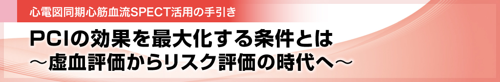 PCIの効果を最大化する条件とは