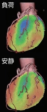 負荷・安静