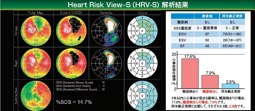 Heart Risk View-S 解析結果