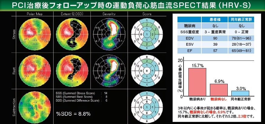 PCI治療後フォローアップ時の運動負荷心筋血流SPECT結果