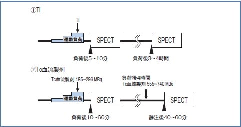 運動負荷心筋シンチグラフィの一般的なプロトコル