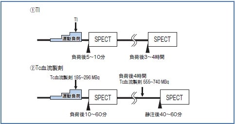 運動負荷心筋シンチグラフィの一般的なプロトコル