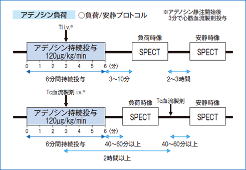 薬剤負荷（アデノシン）心筋シンチグラフィの一般的なプロトコル