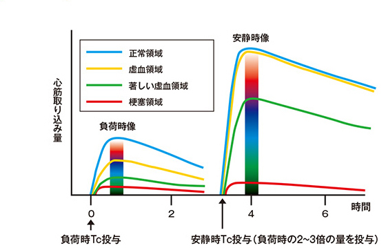 Tc標識製剤の心筋動態の経時的変化（負荷先行の場合）