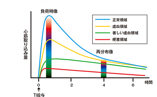 Tlの心筋動態の経時的変化.jpg