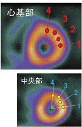 心基部と中央部のSPECT画像