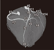 CTAによる冠動脈の走行