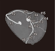CATによる冠動脈の走行2