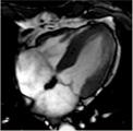 シネMRI 画像例