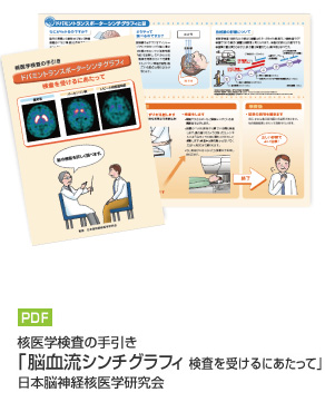 参考資料　ドパミントランスポーターシンチグラフィ検査を受けるにあたって